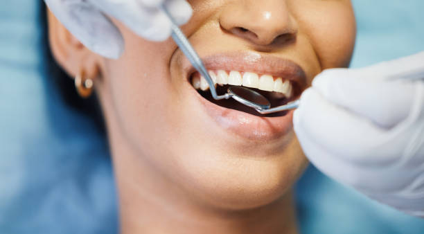 Laser Dentistry in Fort Wayne, IN